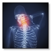 medical image example of neck aches from tmj pain